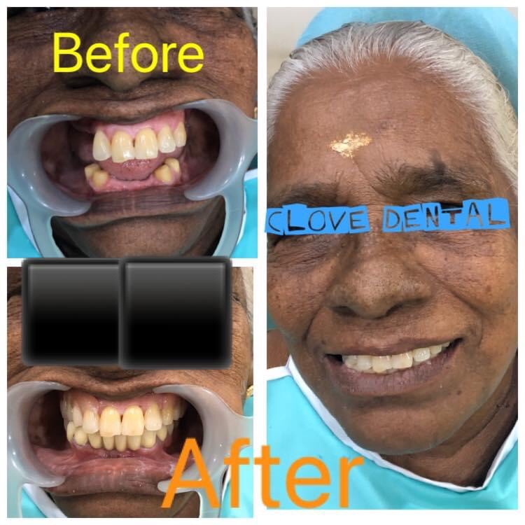 CLOVE DENTAL CLINIC KURAVILANGAD