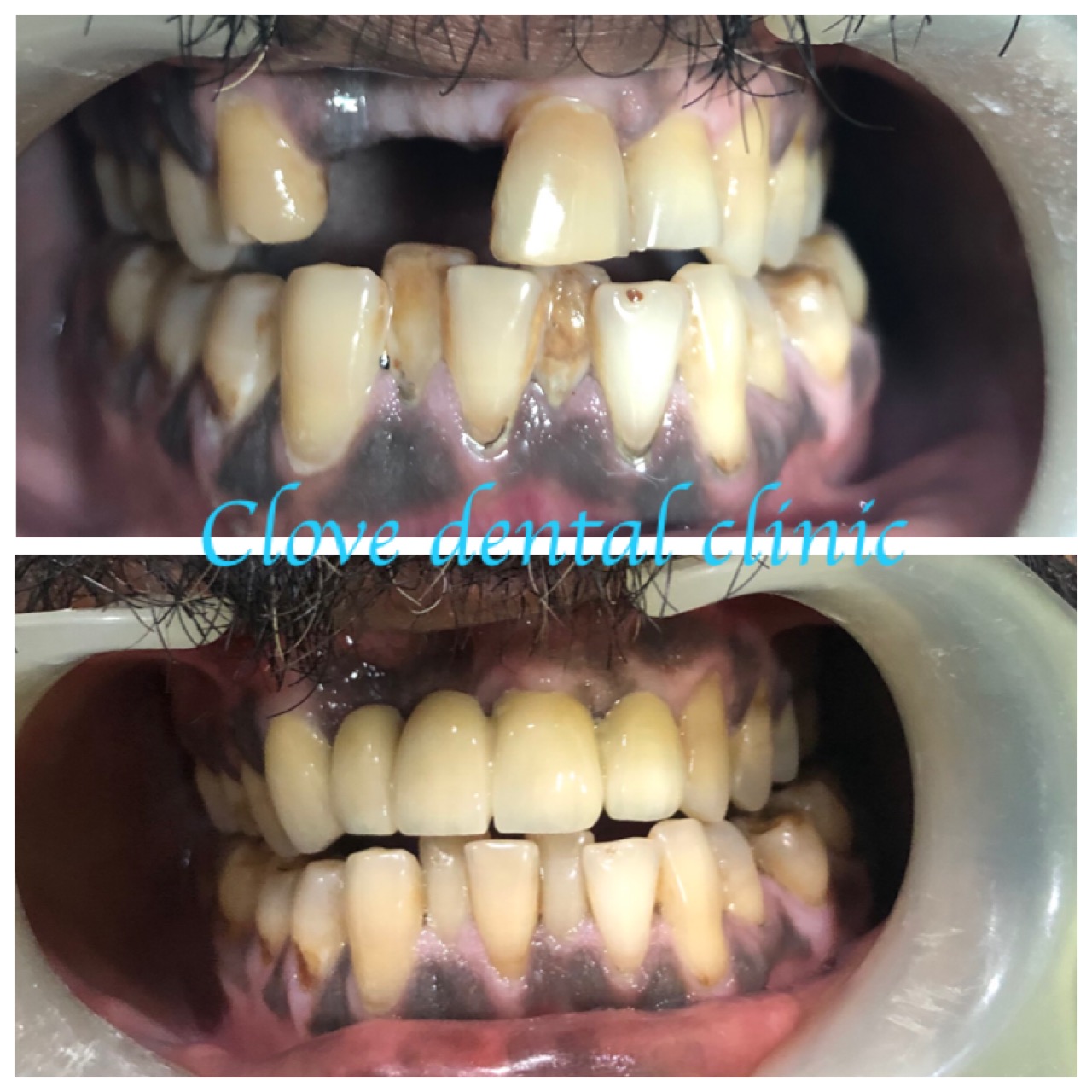 CLOVE DENTAL CLINIC KURAVILANGAD